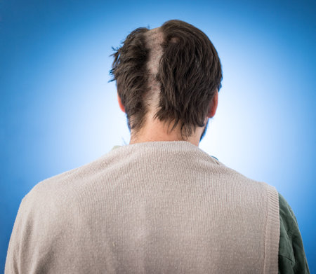 Conceptual artistic face portait photo of a man