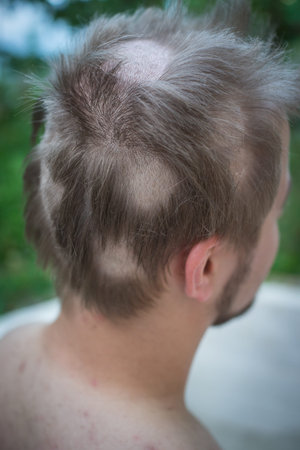 Young man closeup portrait with damaged hairの写真素材