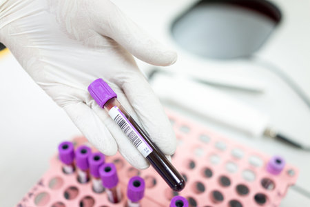 Hospital samples of donated blood indoors, high quality