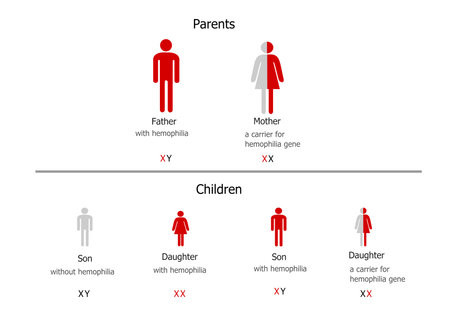 Hemophilia inheritance - father with hemophilia and carrier motherのイラスト素材